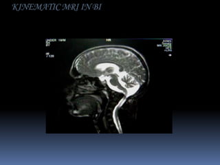 KINEMATIC MRI IN BI

 