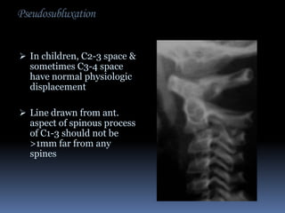 Pseudosubluxation
 In children, C2-3 space &

sometimes C3-4 space
have normal physiologic
displacement

 Line drawn from ant.

aspect of spinous process
of C1-3 should not be
>1mm far from any
spines

 