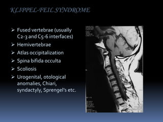 KLIPPEL-FEIL SYNDROME
 Fused vertebrae (usually







C2-3 and C5-6 interfaces)
Hemivertebrae
Atlas occipitalization
Spina bifida occulta
Scoliosis
Urogenital, otological
anomalies, Chiari,
syndactyly, Sprengel’s etc.

 