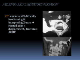 ATLANTO-AXIAL ROTATORY FIXATION
CT: essential d/t difficulty
in obtaining &
interpreting X-rays 
rotated atlas +
displacement, fractures,
AORF

 