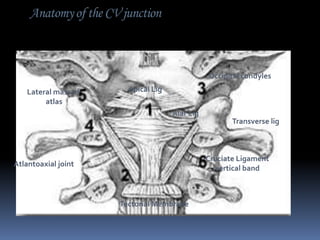 Anatomy of the CV junction

Occipital condyles
Lateral mass of
atlas

Apical Lig
Alar Lig
Transverse lig

Cruciate Ligament
vertical band

Atlantoaxial joint

Tectorial Membrane

 