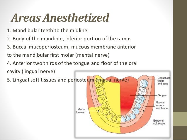 Inferior Alveolar Nerve Block In Children