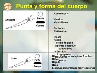 Punta y forma del cuerpo Aponeurosis  Nervios  Vías biliares  Peritoneo  Duramadre  Pleura  Fascia  Tejido adiposo  Aparato digestivo  subcutáneo  Músculos  S. urogenital  Miocardio  Vasos  Disección roma en tejidos friables Riñón Hígado Bazo Ligadura del prolapso Cervicouterino  