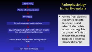 Pathophysiology
Intimal Hyperplasia
• Factors from platelets,
leukocytes, smooth
muscle cells, and
extracellular matrix
interact and regulate
the process of intimal
hyperplasia, making
each step a potential
therapeutic target
 