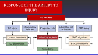 RESPONSE OF THE ARTERY TO
INJURY
ANGIOPLASTY
 