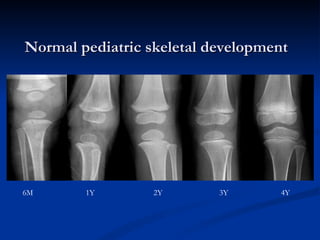 Normal pediatric skeletal development 6M  1Y  2Y  3Y  4Y 