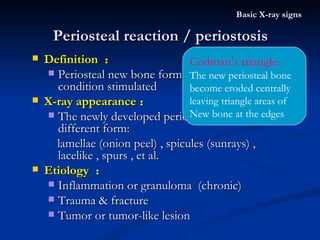 Periosteal reaction / periostosis Basic X-ray signs Definition  ： Periosteal new bone formation cause by various condition stimulated X-ray appearance ： The newly developed periosteal bone in different form:  lamellae (onion peel) , spicules (sunrays) , lacelike , spurs , et al. Etiology  ： Inflammation or granuloma  (chronic) Trauma & fracture Tumor or tumor-like lesion Codman ’ s triangle: The new periosteal bone  become eroded centrally  leaving triangle areas of New bone at the edges  