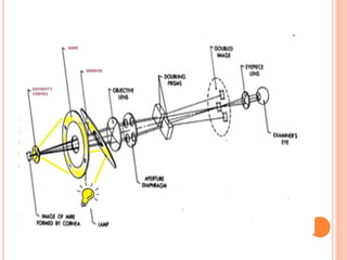 keratometry-180905154718.pdf