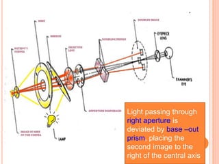 Light passing through
right aperture is
deviated by base –out
prism, placing the
second image to the
right of the central axis
 