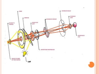 keratometry-180905154718.pdf