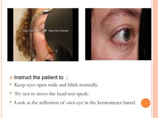  Instruct the patient to :
• Keep eyes open wide and blink normally.
• Try not to move the head nor speak.
• Look at the reflection of own eye in the keratometer barrel
 