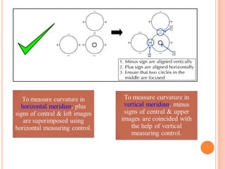 keratometry-180905154718.pdf