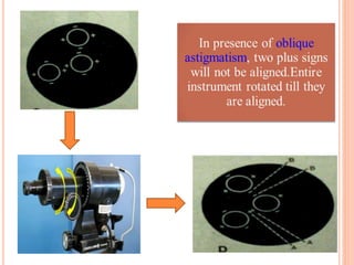 keratometry-180905154718.pdf