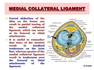 MEDIAL COLLATERAL LIGAMENT
 Forced abduction of the
tibia on the femur can
result in partial tearing of
the medial collateral
ligament, which can occur
at its femoral or tibial
attachments.
 It is useful to remember
that tears of the menisci
result in localized
tenderness on the joint
line, whereas sprains of the
medial collateral ligament
result in tenderness over
the femoral or tibial
attachments of the
ligament. Dr M Eladl
 