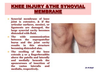 KNEE INJURY &THE SYNOVIAL
MEMBRANE
 Synovial membrane of knee
joint is extensive, & if the
articular surfaces, menisci, or
ligaments are damaged, the
large synovial cavity becomes
distended with fluid.
 The wide communication
between the suprapatellar
bursa and the joint cavity
results in this structure
becoming distended also.
 The swelling of the knee
extends 3 or 4 fingerbreadths
above the patella and laterally
and medially beneath the
aponeuroses of insertion of
the vastus lateralis and
medialis, respectively.
Dr M Eladl
 