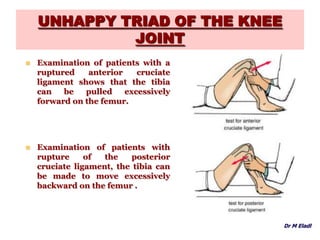 UNHAPPY TRIAD OF THE KNEE
JOINT
 Examination of patients with a
ruptured anterior cruciate
ligament shows that the tibia
can be pulled excessively
forward on the femur.
 Examination of patients with
rupture of the posterior
cruciate ligament, the tibia can
be made to move excessively
backward on the femur .
Dr M Eladl
 