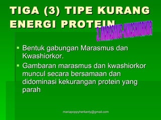 TIGA (3) TIPE KURANG ENERGI PROTEIN Bentuk gabungan Marasmus dan Kwashiorkor. Gambaran marasmus dan kwashiorkor muncul secara bersamaan dan didominasi kekurangan protein yang parah 3. MARASMUS-KWASHIORKOR 