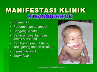 MANIFESTASI KLINIK Edema (+) Pertumbuhan terlambat Cengeng, Apatis Berkurangnya Jaringan lemak sub kutan Perubahan rambut (tipis, lurus,jarang,mudah dicabut) Pigmentasi kulit Moon-face KWASHIORKOR 