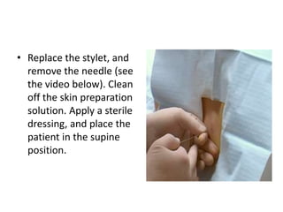 • Replace the stylet, and
remove the needle (see
the video below). Clean
off the skin preparation
solution. Apply a sterile
dressing, and place the
patient in the supine
position.
 