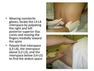 • Wearing nonsterile
gloves, locate the L3-L4
interspace by palpating
the right and left
posterior superior iliac
crests and moving the
fingers medially toward
the spine
• Palpate that interspace
(L3-L4), the interspace
above (L2-L3), and the
interspace below (L4-L5)
to find the widest space.
 