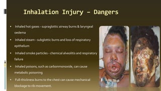 Inhalation Injury – Dangers
 Inhaled hot gases - supraglottic airway burns & laryngeal
oedema
 Inhaled steam - subglottic burns and loss of respiratory
epithelium
 Inhaled smoke particles - chemical alveolitis and respiratory
failure
 Inhaled poisons, such as carbonmonoxide, can cause
metabolic poisoning
 Full-thickness burns to the chest can cause mechanical
blockage to rib movement.
 