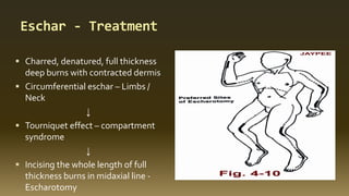 Eschar - Treatment
 Charred, denatured, full thickness
deep burns with contracted dermis
 Circumferential eschar – Limbs /
Neck
↓
 Tourniquet effect – compartment
syndrome
↓
 Incising the whole length of full
thickness burns in midaxial line -
Escharotomy
 