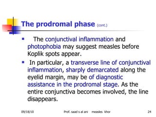 The prodromal phase  (cont.) The  conjunctival inflammation  and  photophobia  may suggest measles before Koplik spots appear. In particular, a  transverse line of conjunctival inflammation ,  sharply demarcated  along the eyelid margin, may be  of diagnostic assistance in the prodromal stage . As the entire conjunctiva becomes involved, the line disappears.  