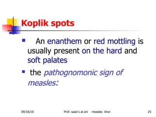 Koplik spots An  enanthem  or  red mottling  is usually present  on the hard  and  soft palates the   pathognomonic sign of measles : 