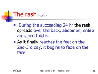 The rash  (cont.) During the succeeding 24 hr  the rash spreads  over the back, abdomen, entire arm, and thighs.  As it finally  reaches the feet on the 2nd-3rd day ,  it begins to fade on the face. 