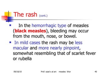 The rash  (cont.) In the  hemorrhagic type  of measles ( black measles ), bleeding may occur from the mouth, nose, or bowel. In mild cases  the rash may be  less macular  and  more nearly pinpoint , somewhat resembling that of scarlet fever or rubella  