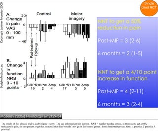 Single
Copyright Lorimer Moseley 2009

                                                                                                                                                              blind RCT



                                                                                                                 NNT to get a 50%
                                                                                                                 reduction in pain

                                                                                                                 Post-MIP = 3 (2-6)

                                                                                                                 6 months = 2 (1-5)
BodyInMind.com.au




                                                                                                                 NNT to get a 4/10 point
                                                                                                                 increase in function

                                                                                                                 Post-MIP = 4 (2-11)

                                                                                                                 6 months = 3 (2-4)

    Moseley (2006) Neurology 67 2129-34

             The results of this clinical trial: a dodgy figure - sorry. The key information is in the box. NNT = number needed to treat, in this case to get a 50%
             reduction in pain, for one patient to get that response that they wouldn’t not get in the control group. Some important caveats here: 1. practice 2. practice 3.
             practice!
 