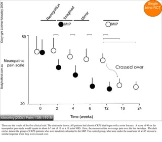 Single
Copyright Lorimer Moseley 2009




                                                                    n
                                                                                                                                                              blind RCT




                                                               it io



                                                                                 d
                                                                              ine
                                                             gn




                                                                                                or
                                                                            ag
                                                           co




                                                                                              irr
                                                                          Im
                                                         Re




                                                                                            M
                                                                            MIP                                             MIP


                                          50




                                 Neuropathic
                                  pain scale
BodyInMind.com.au




                                                                                                                                Crossed over




                                         20
                                                   0                2               4                6               12               18               24

    Moseley(2004) Pain; 108: 192-8;                                               Time (weeks)

             These are the results of the first clinical trial. The citation is shown. All patients had chronic CRPS that began with a wrist fracture. A score of 40 on the
             neuropathic pain scale would equate to about 6-7 out of 10 on a 10 point NRS. Here, the measure refers to average pain over the last two days. The dark
             circles denote the group of CRPS patients who were randomly allocated to the MIP. The control group, who were under the usual care of a GP, showed a
             similar response when they were crossed over.
 