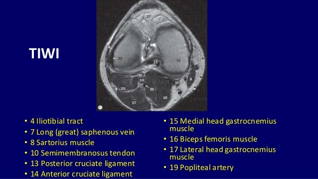 Mri Anatomy Of Knee Dr Muhammad Bin Zulfiqar