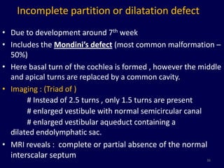 Incomplete partition or dilatation defect
• Due to development around 7th week
• Includes the Mondini’s defect (most common malformation –
  50%)
• Here basal turn of the cochlea is formed , however the middle
  and apical turns are replaced by a common cavity.
• Imaging : (Triad of )
       # Instead of 2.5 turns , only 1.5 turns are present
       # enlarged vestibule with normal semicircular canal
       # enlarged vestibular aqueduct containing a
  dilated endolymphatic sac.
• MRI reveals : complete or partial absence of the normal
  interscalar septum                                       36
 