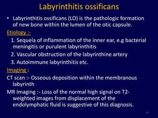 Labyrinthitis ossificans
• Labyrinthitis ossificans (LO) is the pathologic formation
   of new bone within the lumen of the otic capsule.
Etiology :-
  1. Sequela of inflammation of the inner ear, e.g bacterial
   meningitis or purulent labyrinthitis
  2. Vascular obstruction of the labyrinthine artery
  3. Autoimmune labyrinthitis etc.
Imaging :
CT scan :- Osseous deposition within the membranous
   labyrinth
MR Imaging :- Loss of the normal high signal on T2-
   weighted images from displacement of the
   endolymphatic fluid is suggestive of this diagnosis.
                                                           53
 