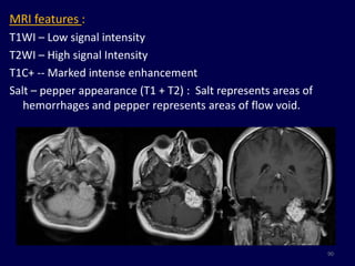 MRI features :
T1WI – Low signal intensity
T2WI – High signal Intensity
T1C+ -- Marked intense enhancement
Salt – pepper appearance (T1 + T2) : Salt represents areas of
   hemorrhages and pepper represents areas of flow void.




                                                                90
 