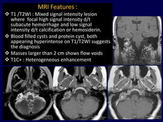 MRI Features :
 T1 /T2WI : Mixed signal intensity lesion
  where focal high signal intensity d/t
  subacute hemorrhage and low signal
  intensity d/t calcification or hemosiderin.
 Blood filled cysts and protein cyst, both
  appearing hyperintense on T1/T2WI suggests
  the diagnosis
 Masses larger than 2 cm shows flow voids
 T1C+ : Heterogeneous enhancement




                                                98
 