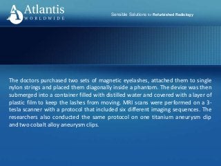 Sensible Solutions for Refurbished Radiology
The doctors purchased two sets of magnetic eyelashes, attached them to single
nylon strings and placed them diagonally inside a phantom. The device was then
submerged into a container filled with distilled water and covered with a layer of
plastic film to keep the lashes from moving. MRI scans were performed on a 3-
tesla scanner with a protocol that included six different imaging sequences. The
researchers also conducted the same protocol on one titanium aneurysm clip
and two cobalt alloy aneurysm clips.
 