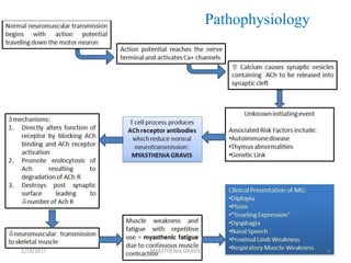 Pathophysiology
2/19/2017 8MYASTHENIA GRAVIS
 