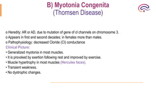 myopthies.pptx