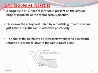 ANTEGONIAL NOTCH
 A single field of surface resorption is present on the inferior
edge of mandible at the ramus corpus junction.
 This forms the antegonial notch by remodelling from the ramus
just behind it as the ramus relocates posteriorly
 The size of the notch can be increased whenever a downward
rotation of corpus relative to the ramus takes place
553/1/2017 99
 