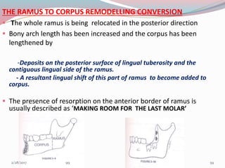 THE RAMUS TO CORPUS REMODELLING CONVERSION
 The whole ramus is being relocated in the posterior direction
 Bony arch length has been increased and the corpus has been
lengthened by
-Deposits on the posterior surface of lingual tuberosity and the
contiguous lingual side of the ramus.
- A resultant lingual shift of this part of ramus to become added to
corpus.
 The presence of resorption on the anterior border of ramus is
usually described as ‘MAKING ROOM FOR THE LAST MOLAR’
593/1/2017 99
 