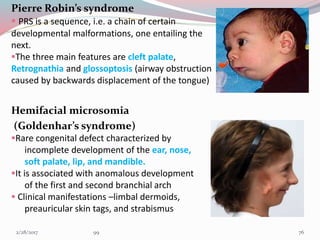 Pierre Robin’s syndrome
 PRS is a sequence, i.e. a chain of certain
developmental malformations, one entailing the
next.
The three main features are cleft palate,
Retrognathia and glossoptosis (airway obstruction
caused by backwards displacement of the tongue)
Hemifacial microsomia
(Goldenhar’s syndrome)
Rare congenital defect characterized by
incomplete development of the ear, nose,
soft palate, lip, and mandible.
It is associated with anomalous development
of the first and second branchial arch
 Clinical manifestations –limbal dermoids,
preauricular skin tags, and strabismus
763/1/2017 99
 