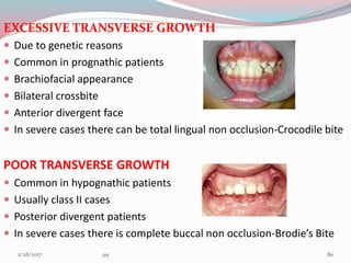 EXCESSIVE TRANSVERSE GROWTH
 Due to genetic reasons
 Common in prognathic patients
 Brachiofacial appearance
 Bilateral crossbite
 Anterior divergent face
 In severe cases there can be total lingual non occlusion-Crocodile bite
POOR TRANSVERSE GROWTH
 Common in hypognathic patients
 Usually class II cases
 Posterior divergent patients
 In severe cases there is complete buccal non occlusion-Brodie’s Bite
803/1/2017 99
 