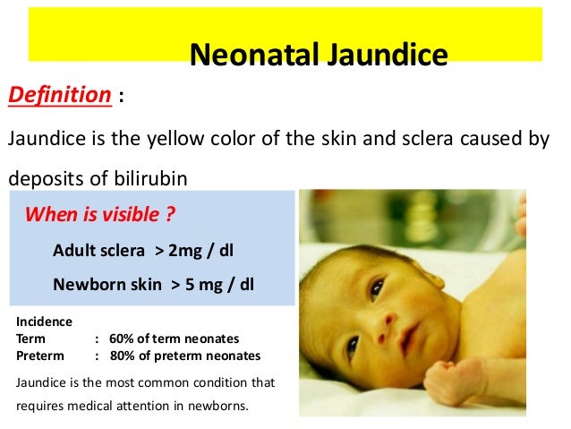 Neonatal jaundice