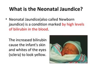 Neonatal jaundice | PPT