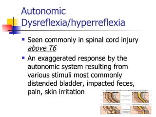 Autonomic Dysreflexia/hyperreflexia Seen commonly in spinal cord injury  above T6 An exaggerated response by the autonomic system resulting from various stimuli most commonly distended bladder, impacted feces, pain, skin irritation 