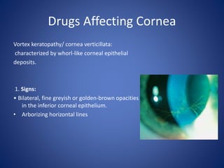 Drugs Affecting Cornea
Vortex keratopathy/ cornea verticillata:
characterized by whorl-like corneal epithelial
deposits.
1. Signs:
• Bilateral, fine greyish or golden-brown opacities
in the inferior corneal epithelium.
• Arborizing horizontal lines
 