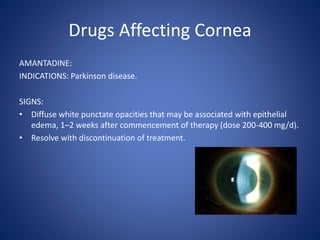 Drugs Affecting Cornea
AMANTADINE:
INDICATIONS: Parkinson disease.
SIGNS:
• Diffuse white punctate opacities that may be associated with epithelial
edema, 1–2 weeks after commencement of therapy (dose 200-400 mg/d).
• Resolve with discontinuation of treatment.
 