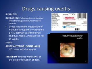 Drugs causing uveitis
RIFABUTIN:
INDICATIONS: Tuberculosis in combination
with other drugs in immunocompetent
patients.
• Drugs that inhibit metabolism of
rifabutin through the cytochrome
p-450 pathway (clarithromycin
and fluconazole), increase the risk
of uveitis.
SIGNS:
ACUTE ANTERIOR UVEITIS (AAU)
U/L; assoc with hypopyon;
Treatment involves withdrawal of
the drug or reduction of dose.
 